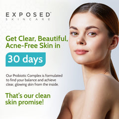 exposed skin care probiotic tablet chart highlights mineral and vitamin blend