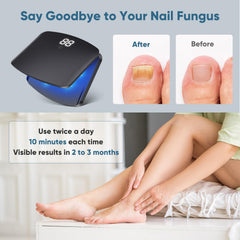 FEIGOMA Nail Fungus Light Device control panel is in use.