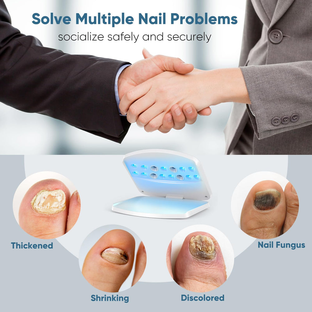 FEIGOMA Nail Fungus Light Device foot in use for toenail care