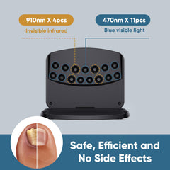 FEIGOMA Nail Fungus Light Device is shown in hand for simple at-home care.