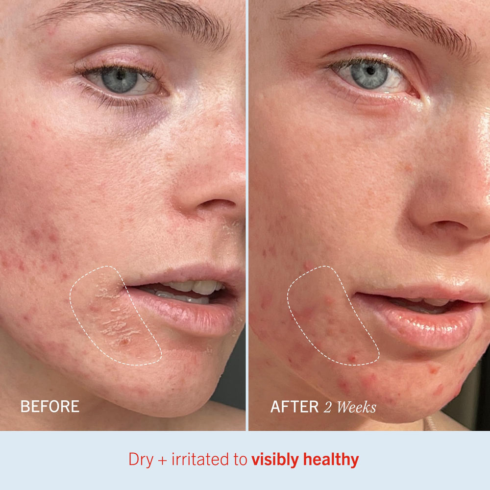 Body application of First Aid Beauty Ultra Repair Cream for full-body hydration