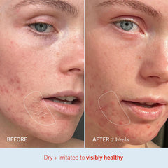 Body application of First Aid Beauty Ultra Repair Cream for full-body hydration