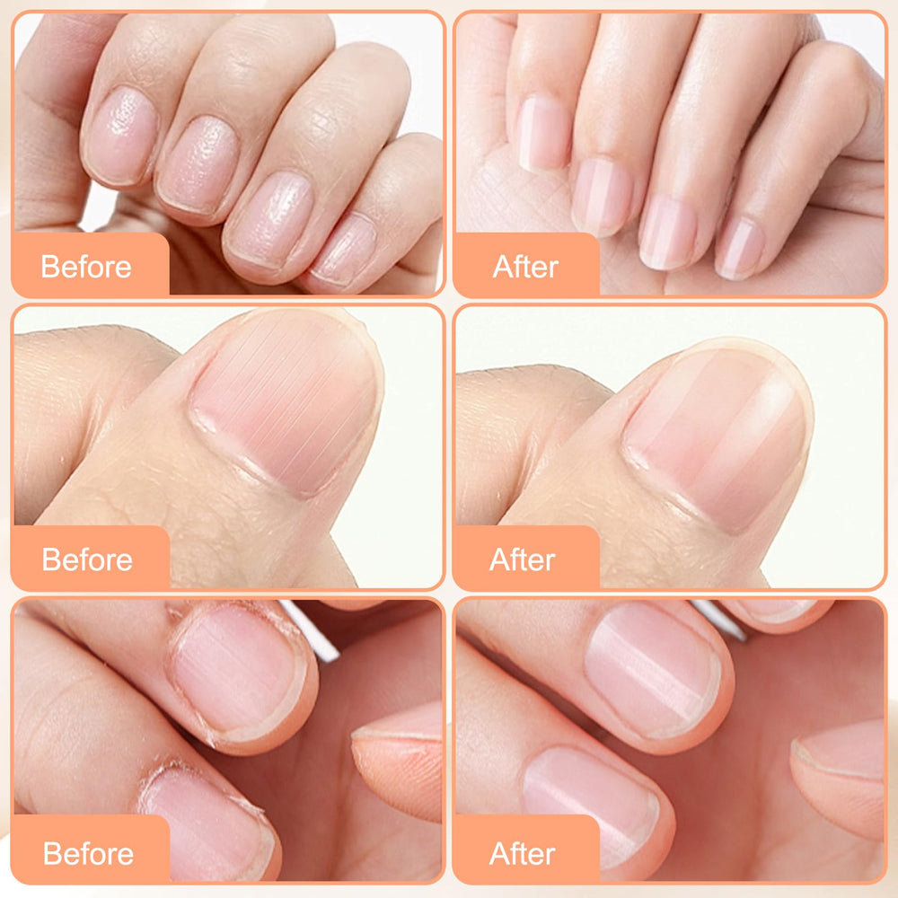 FIYADWZH Hands showing improved nail texture with routine use.