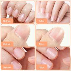 FIYADWZH Hands showing improved nail texture with routine use.