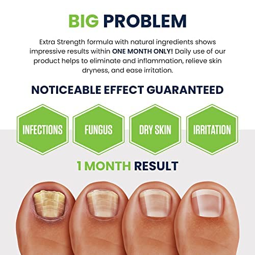 FOOT CURE foot odor soak for fresh, comfortable feet