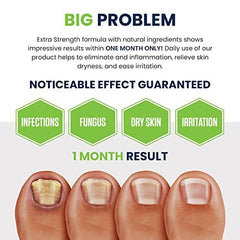 FOOT CURE foot odor soak for fresh, comfortable feet