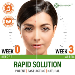 GRAMRIGHT Probiotic capsules highlighting gut-skin synergy for clearer skin potential.