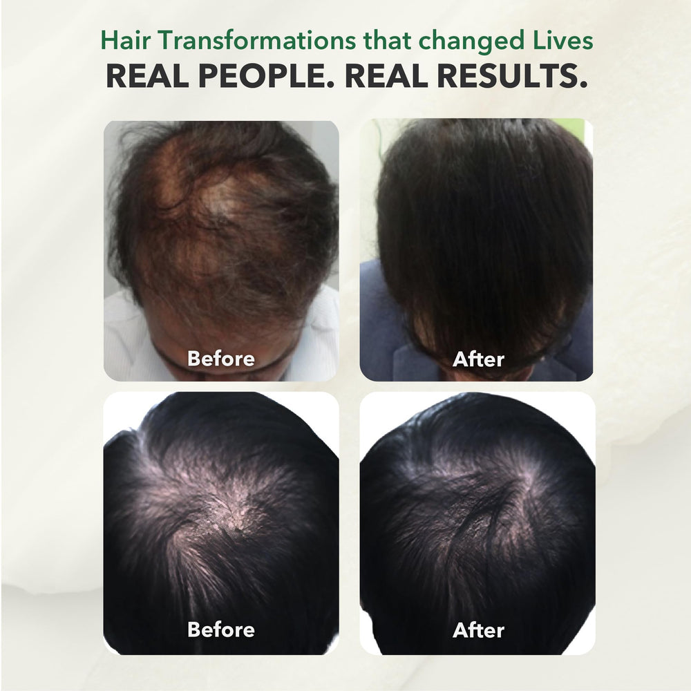 HairSmart vegan-friendly, allergen-free formula displayed on supplement facts label.