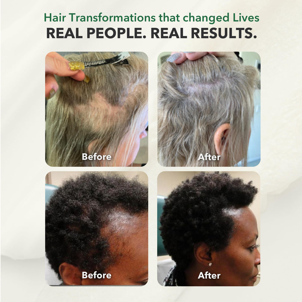 HairSmart Vegan Gluten-Free Formula bottle with allergen-free icon.