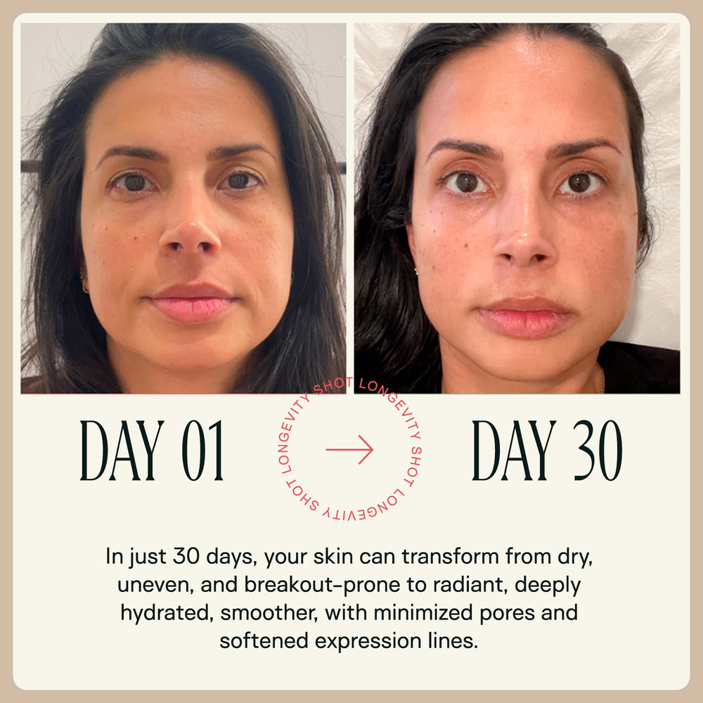 Happy Aging NAD+ shot supports a simple twice-weekly routine