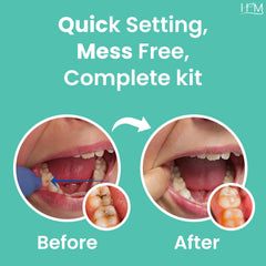 Happy Moms tweezers help careful handling during dental repairs