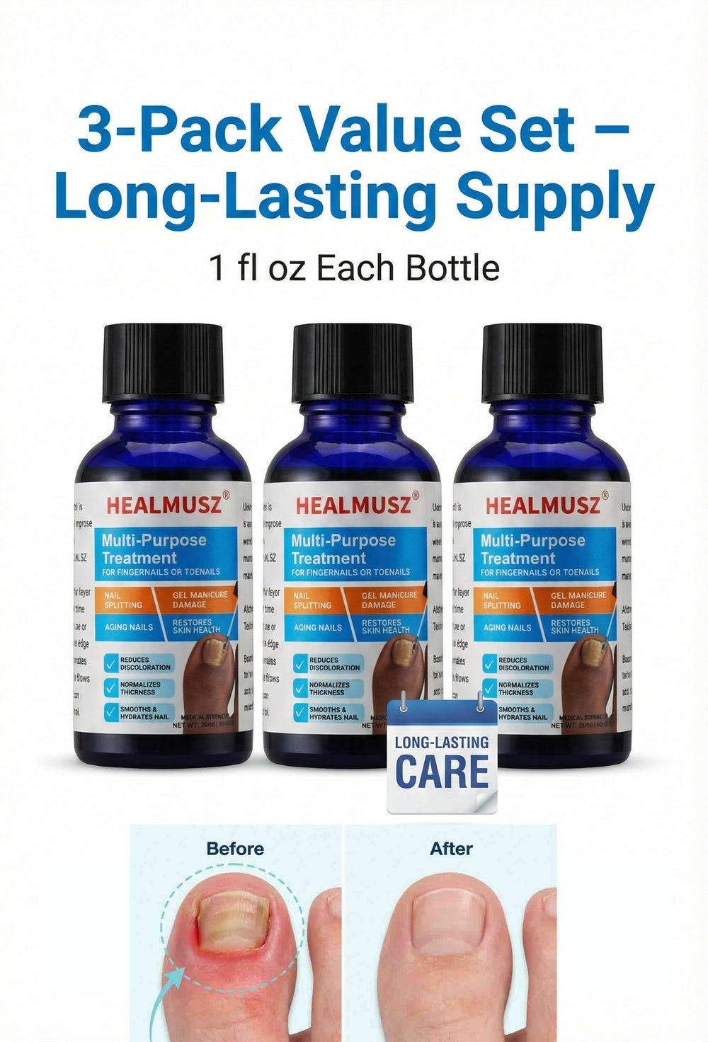 HEALMUSZ herbal-enhanced formula with Euphorbia Hirta and Pseudolarix extracts