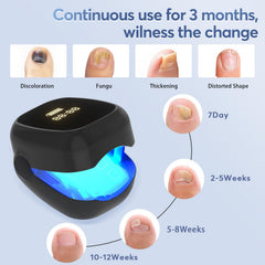 HITDER infrared blue light diodes on nail plate detail for targeted care