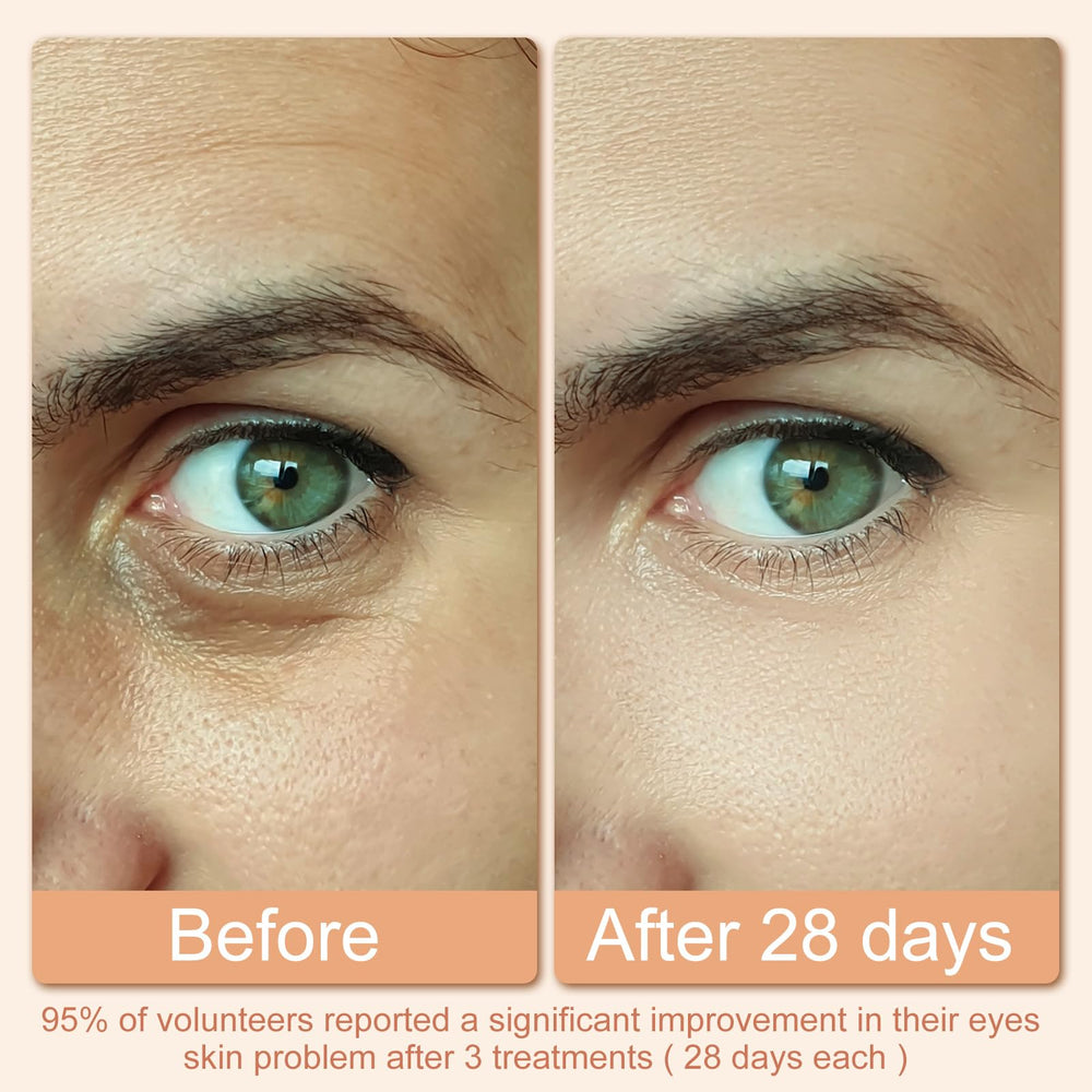Hoakya eye massage at home soothes tired eyes during long screen sessions.