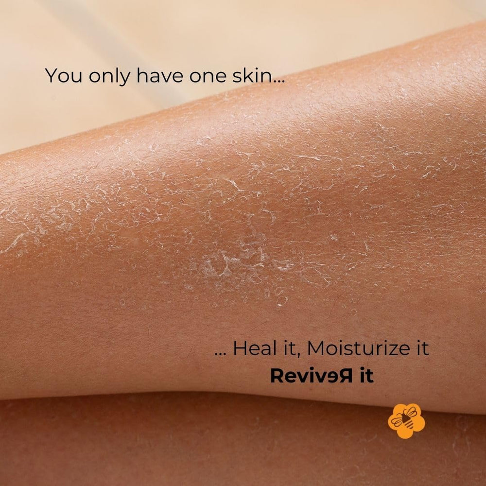 Cream nourishing extremely dry skin areas like elbows and feet