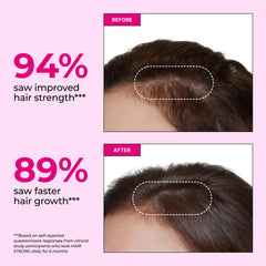 Hum Hair Strong strawberry-flavor gummies for daily hair support.