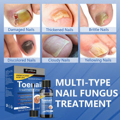 IFUNSHAR close-up of yellowed nails before treatment.