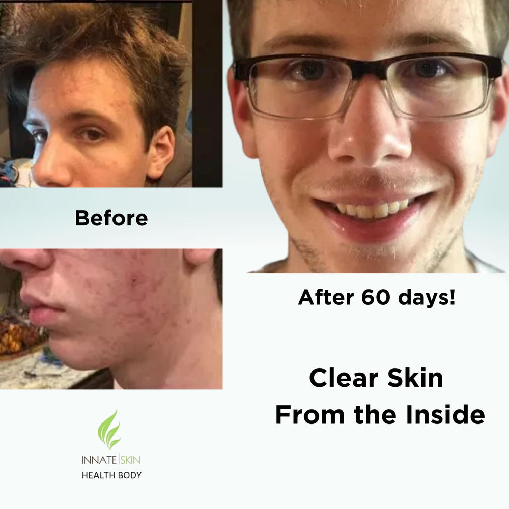 Innate Skin tablets closeup — plant-based capsules highlighting key ingredients