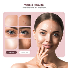 INTEO eye mask integration protecting eyes during sessions.