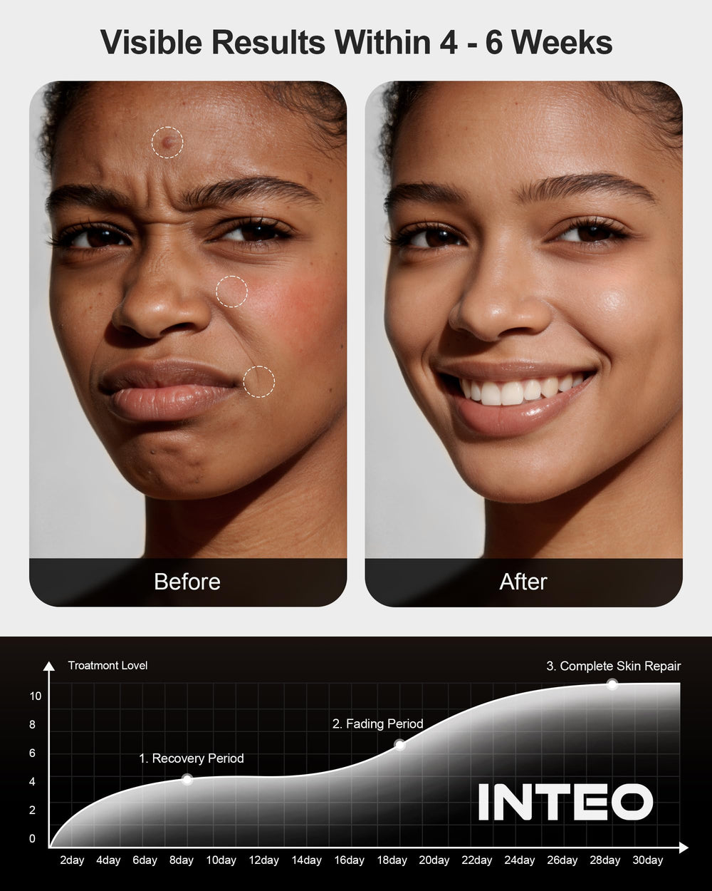 INTEO therapy panel suitable for relaxing back and facial areas