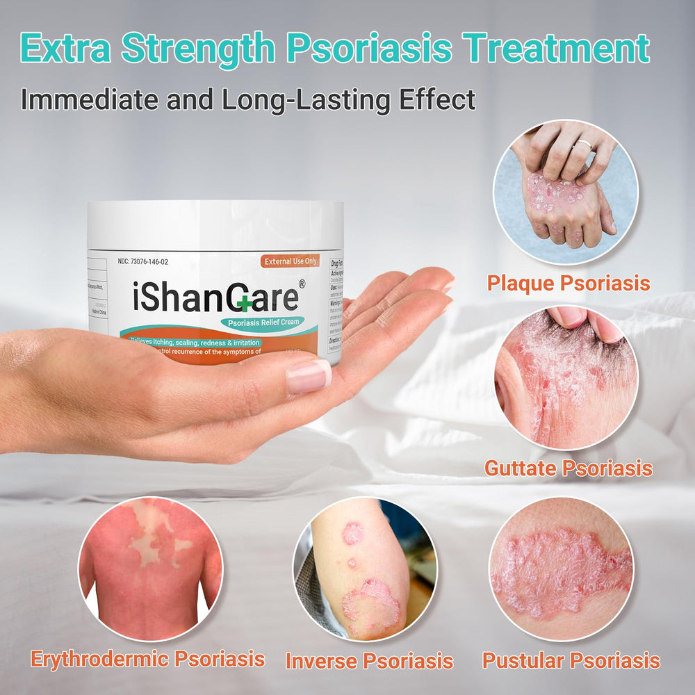 Ishancare Psoriasis Cream jar ready for daily moisturizing on dry patches