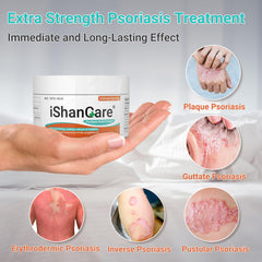 Ishancare Psoriasis Cream jar ready for daily moisturizing on dry patches