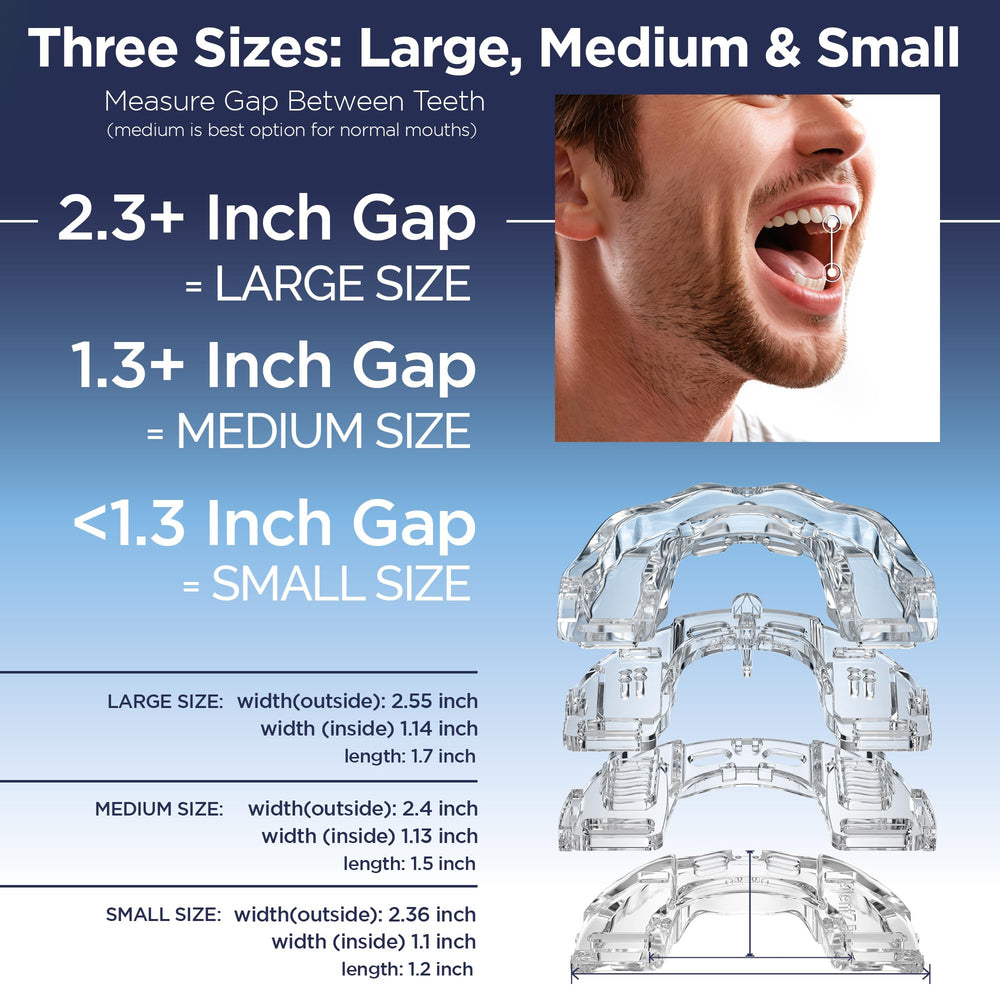 Itus SilentZPro 2.0 mold-and-fit step for secure alignment.