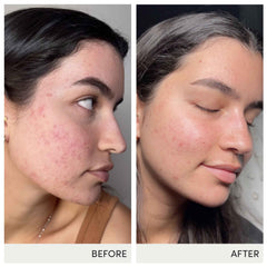 Jane Iredale Skin Accumax vegan and gluten-free formula visible for skin support