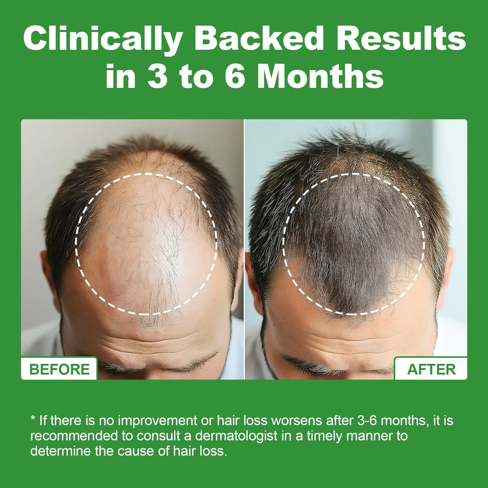Biotin and zinc elements in JOVITHEA support hair vitality