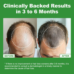 Biotin and zinc elements in JOVITHEA support hair vitality