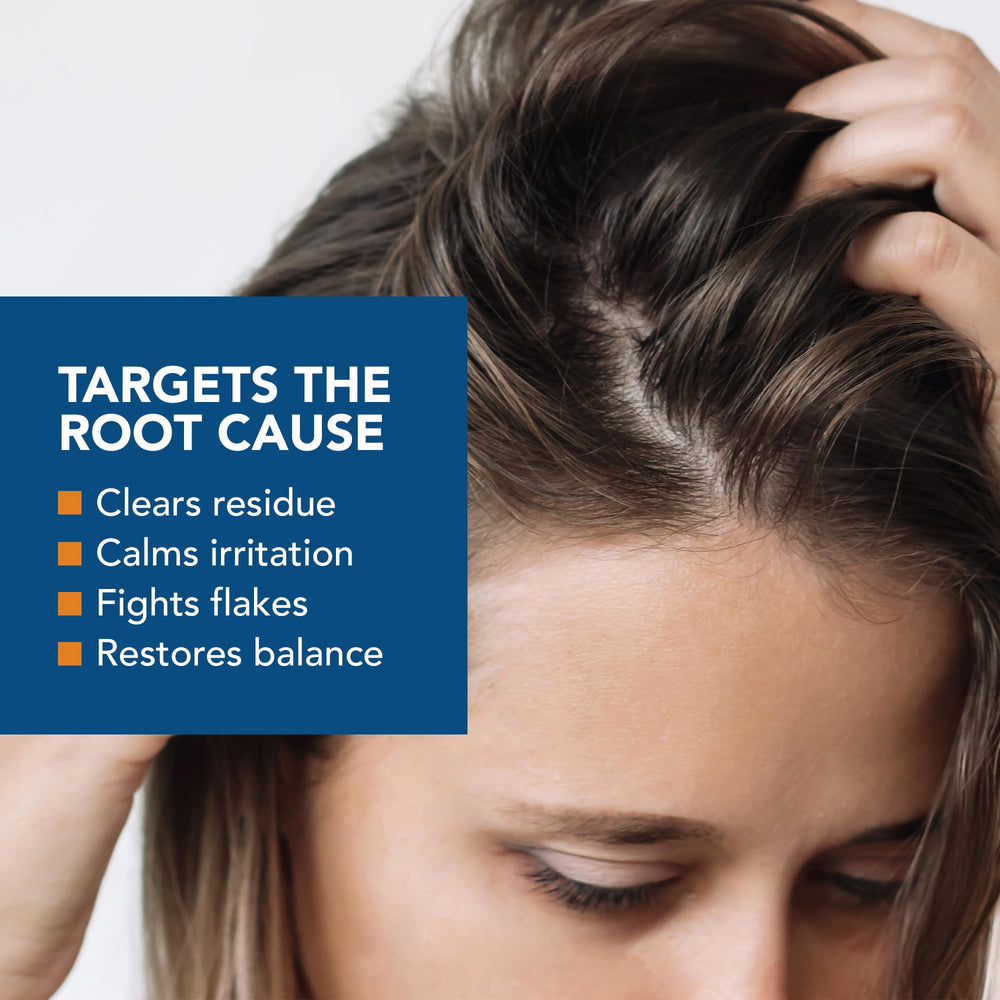 Kenkoderm psoriasis conditioner used on scalp for gentle care