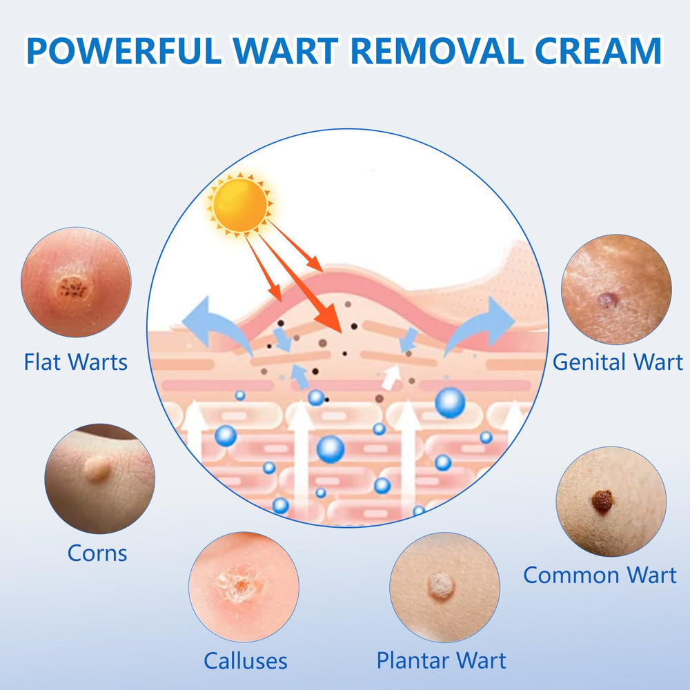 KIbabyDI freeze-off technology graphic illustrating rapid wart action and at-home treatment