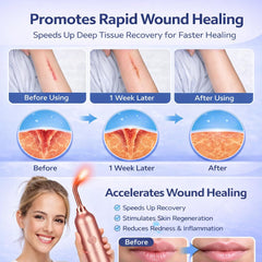 Kingcar red light therapy for knees and legs offers surface warmth and comfort.