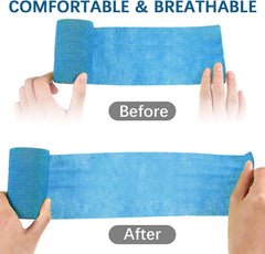 KisSealed bandage wrap with individual packaging keeps rolls clean and portable