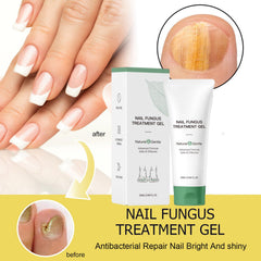KUNLEN Nail Fungus Cream tube closeup highlighting easy absorption and conditioning.