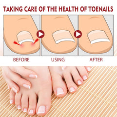 KUNLEN Nail Growth Gel application scene showing massage for absorption.