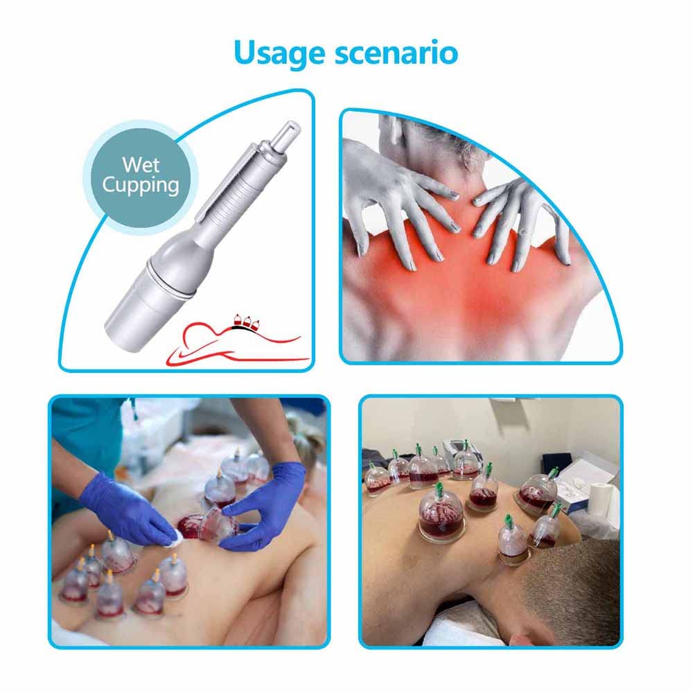 LANBO disposable needles ready for sterile use and safe handling