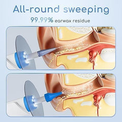 Lebbtl LED lights illuminating the ear canal for better visibility
