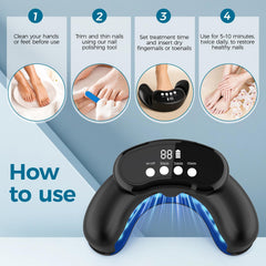 Leeyond Nail Fungus Laser Device close-up LED lights for targeted at-home sessions