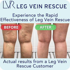 LEG VEIN RESCUE Diosmin bottle label highlights ingredients and benefits.