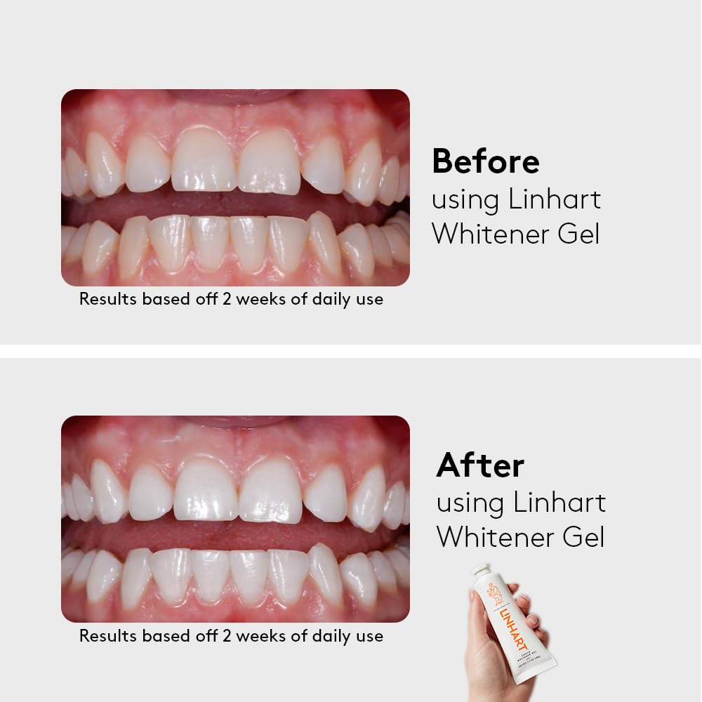 LINHART at-home whitening session setup
