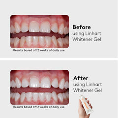 LINHART at-home whitening session setup