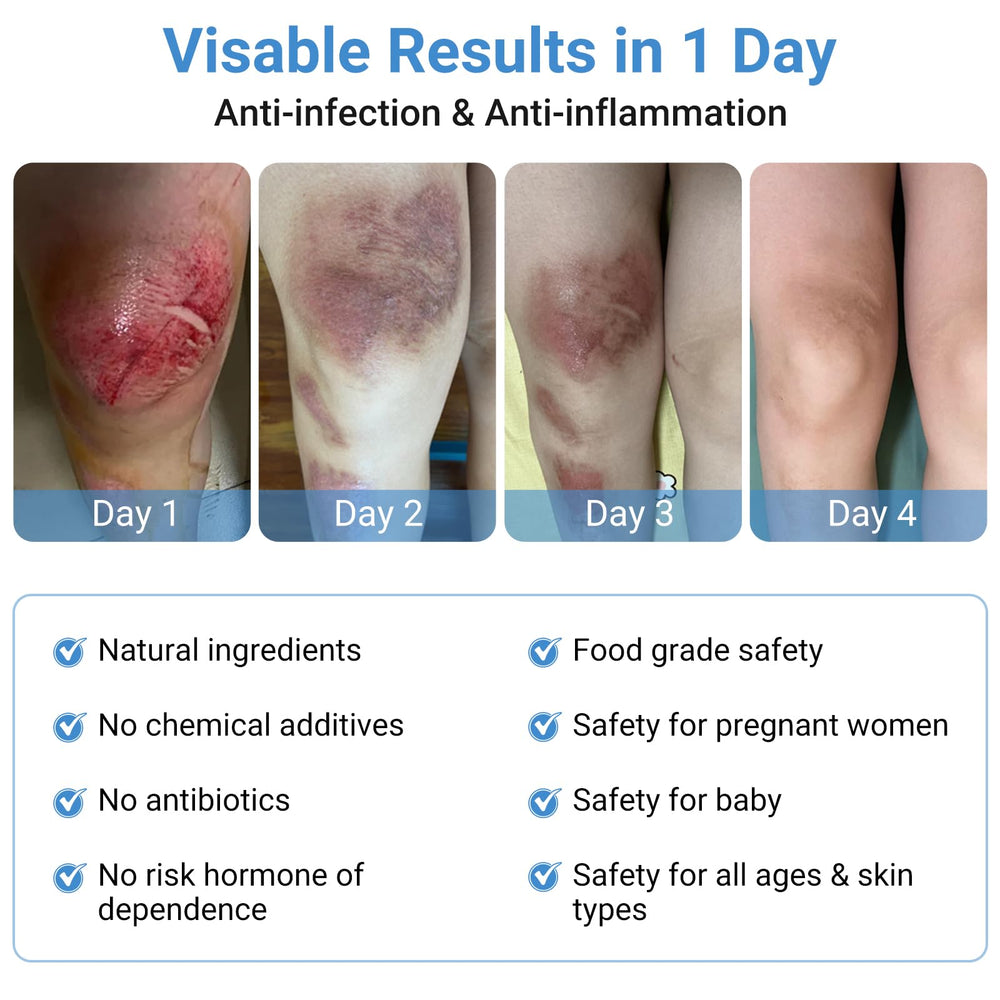 LMNOOP Wound Care Ointment addressing bedsores with natural ingredients for targeted care