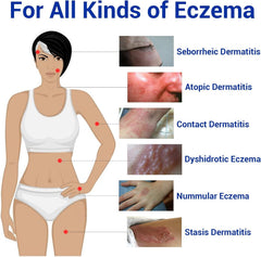LMNOOP Eczema Cream application on arm demonstrates gentle glide