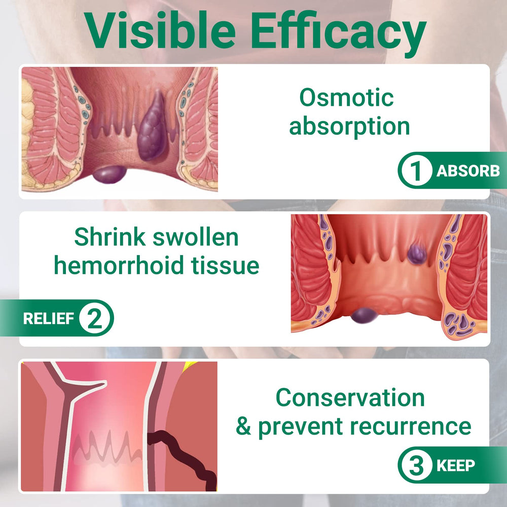 LMNOOP hemorrhoid ointment skin protection focuses on gentle perianal care.