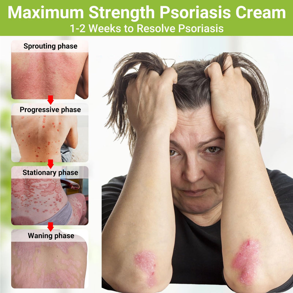 LMNOOP Psoriasis Cream jar texture indicating non greasy, deep moisturization