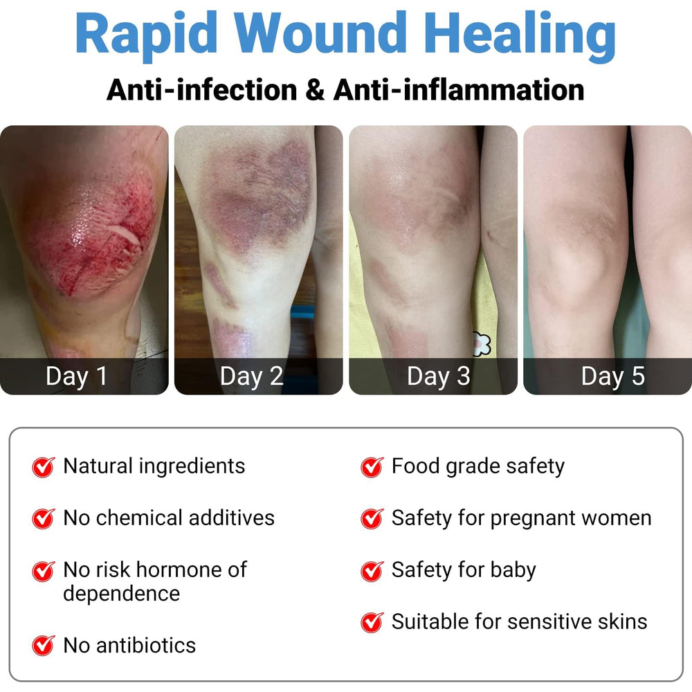 LMNOOP Wound Healing Cream used in home first aid scenarios.