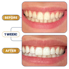 Lumineux Longevity stain-target technology targets coffee, tea, and red wine stains.