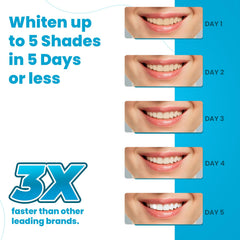 Lumist Advanced Teeth Whitening Strips application closeup demonstrates comfortable fit for even coverage