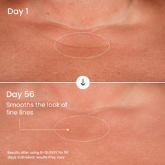 MAËLYS B-GLOSSY chest area showing texture refinement potential.